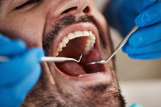 Best Emergency Dentist for Special Needs Patients in Edwards Af, CA